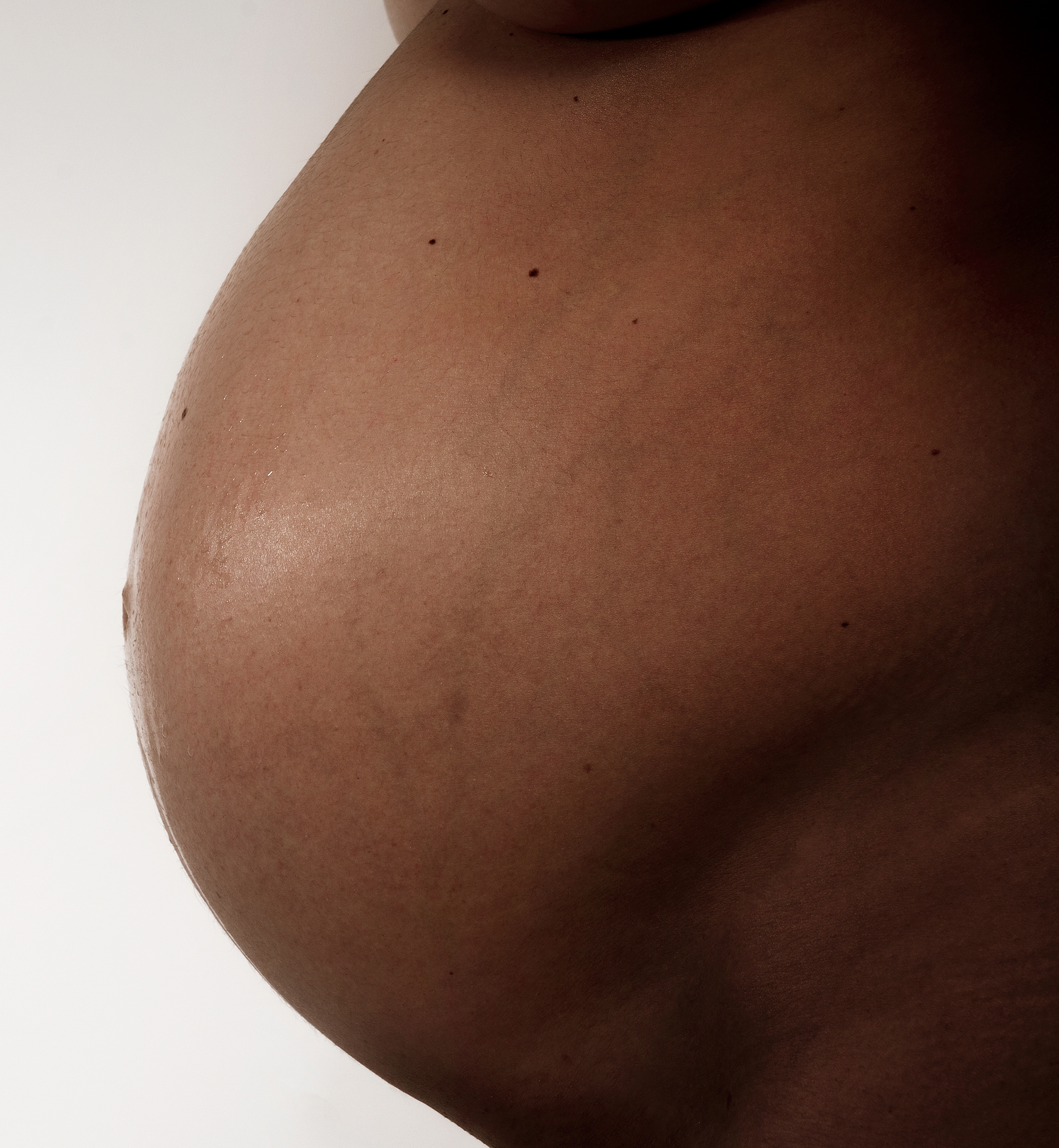 Risques psoriasis grossesse.
