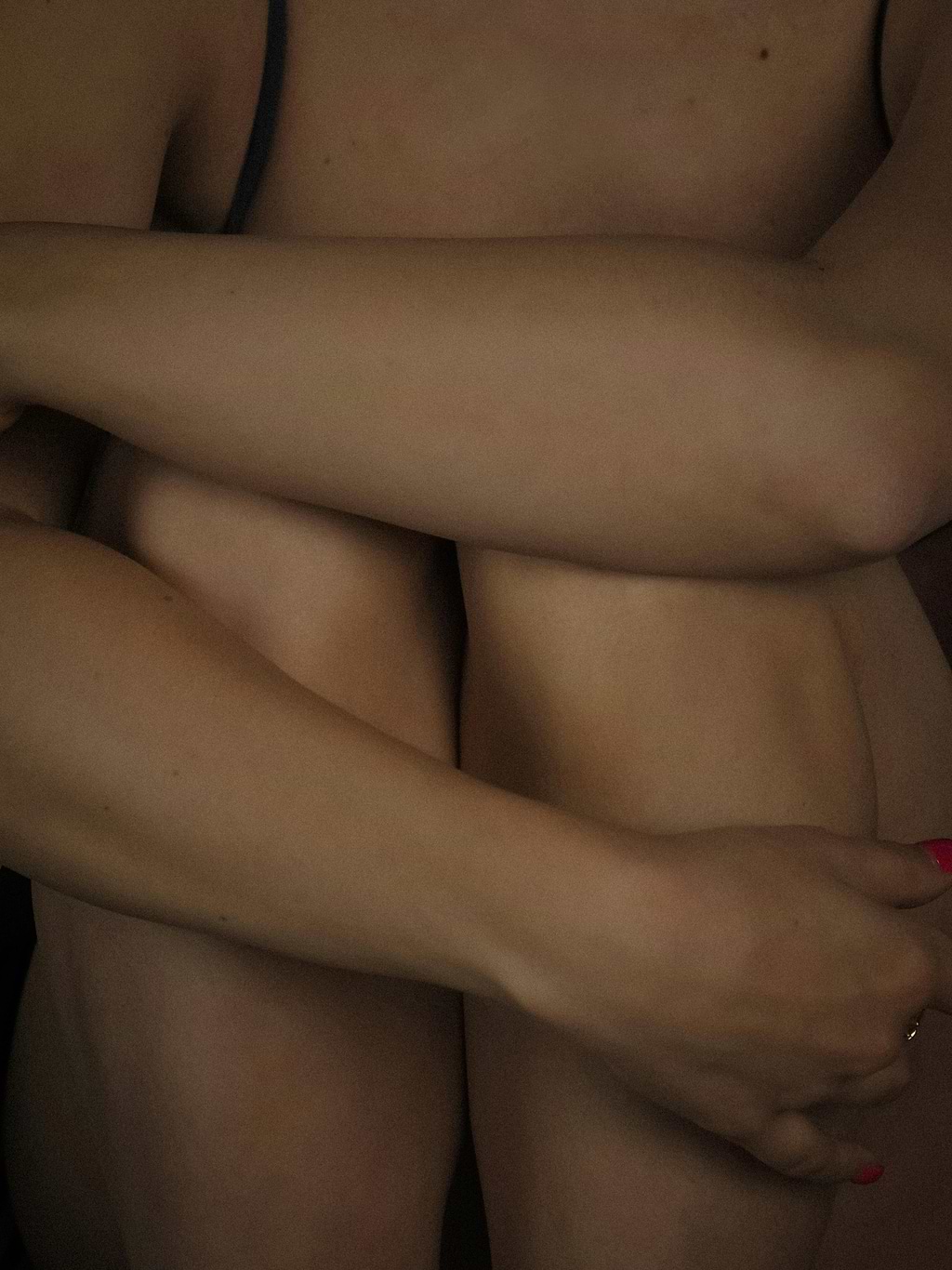 Stades d'évolution varices.