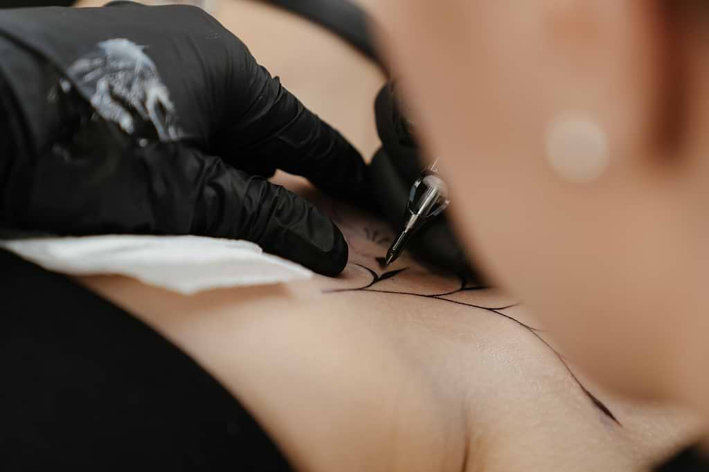 détatouage par le laser.