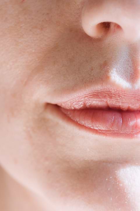 Psoriasis des lèvres : de quoi s'agit-il ?