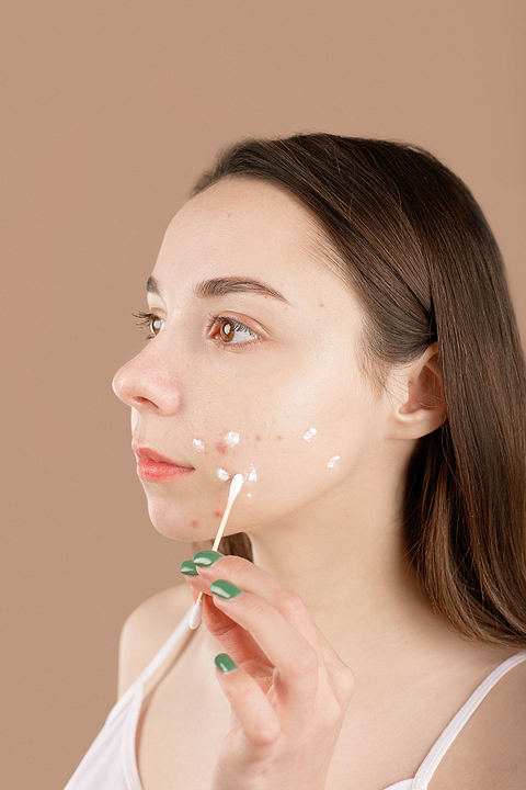 Le dentifrice, une alternative efficace contre les boutons d'acné. Vrai ou faux ?