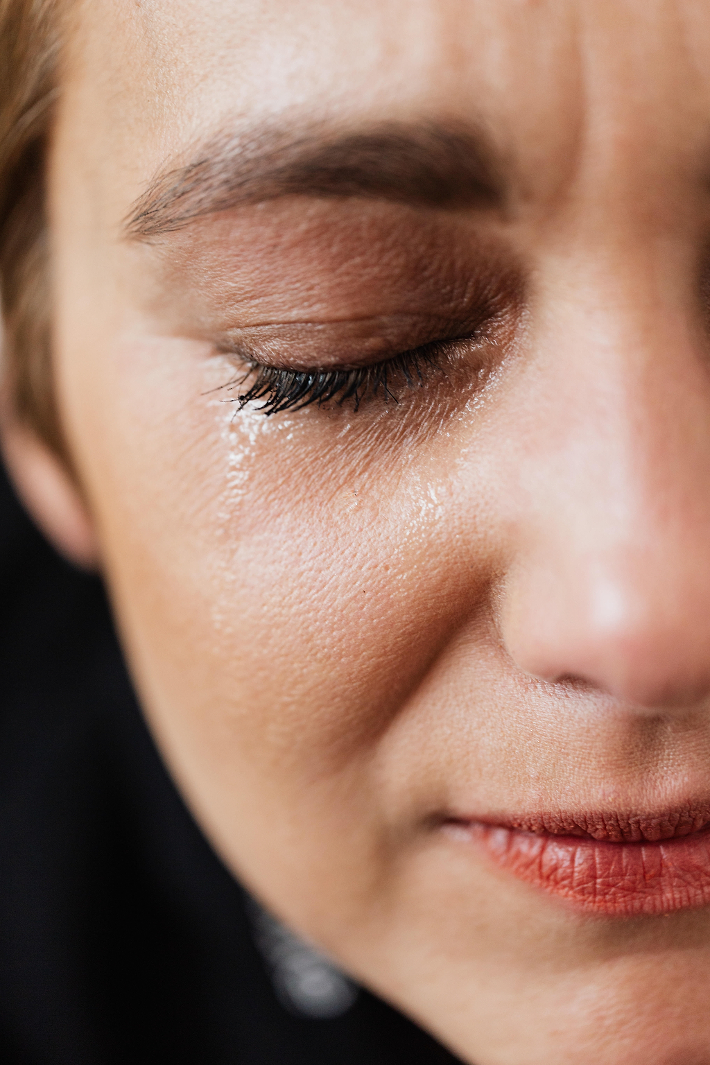 Quels sont les dangers du psoriasis ?