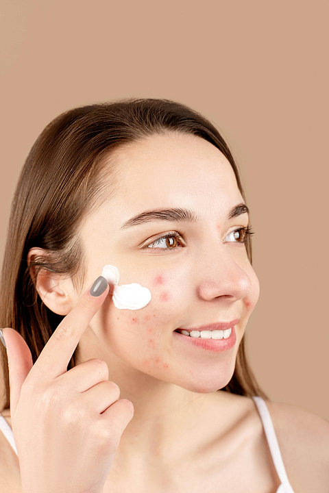Intérêt homéoplasmine contre boutons