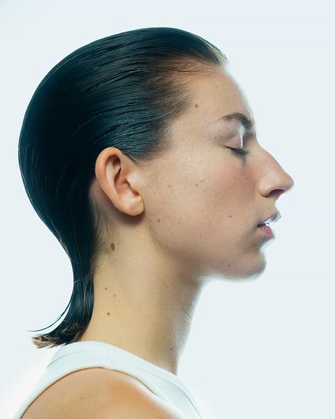 Différents types psoriasis.