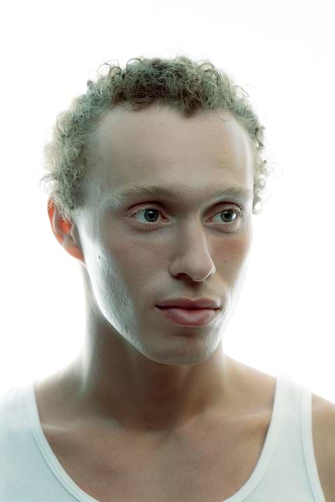 Évaluation sévérité psoriasis.