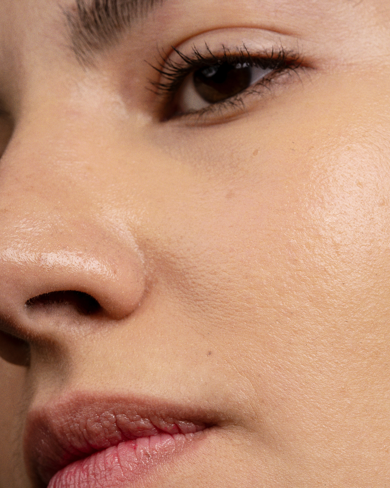 Pourquoi a-t-on la peau sèche ?