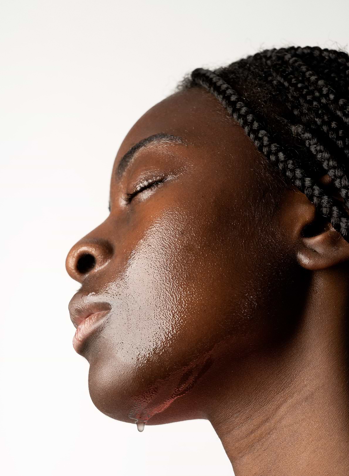 Eczéma peau noire.