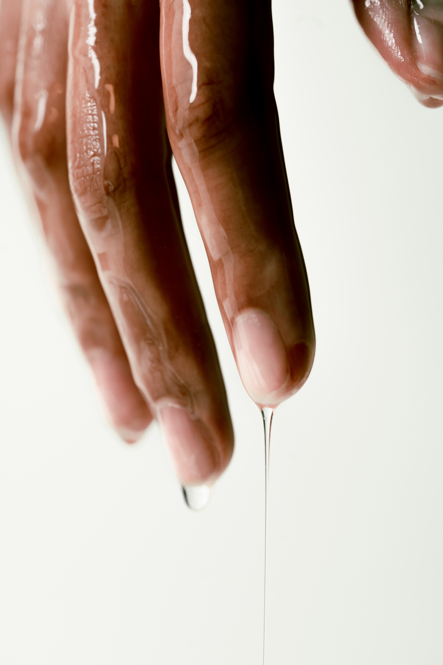 Effets de l'huile de nigelle sur une mycose de l'ongle.