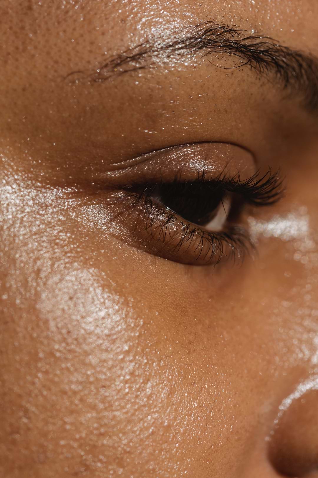 Causes peau grasse.