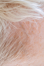 Fiche d'identité : Cheveux blancs/gris (canitie).