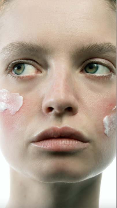 Interview dermatologue rosacée vie quotidienne.