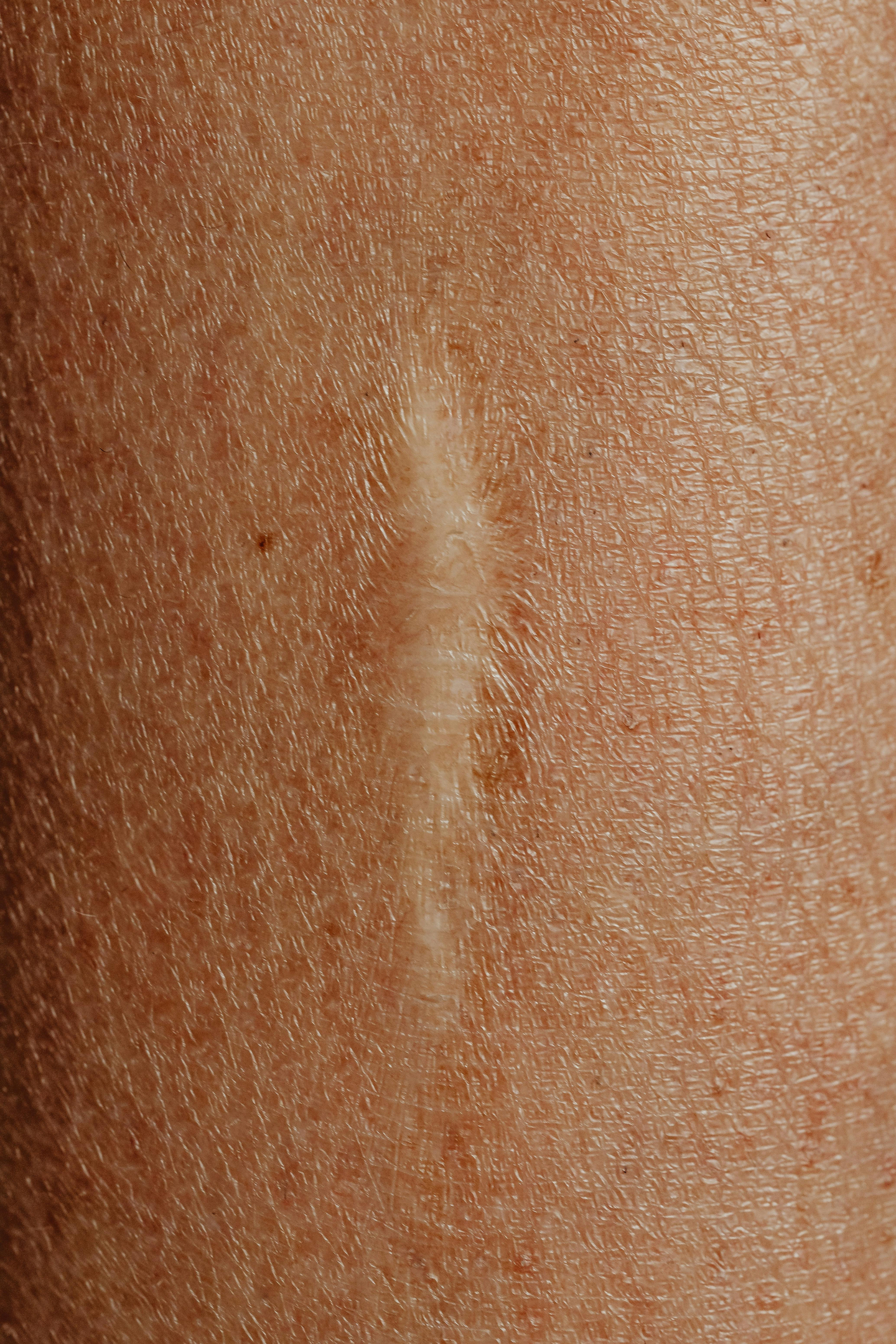 Pouvoir cicatrisant huile de pracaxi.