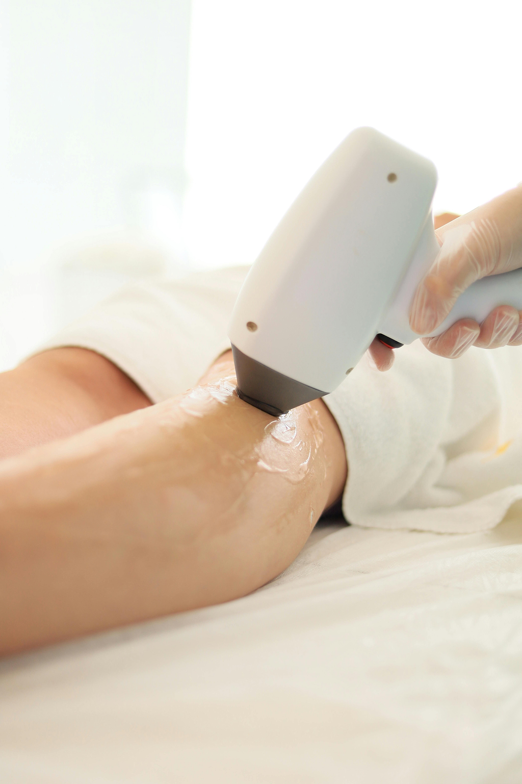 Efficacité laser kératose pilaire