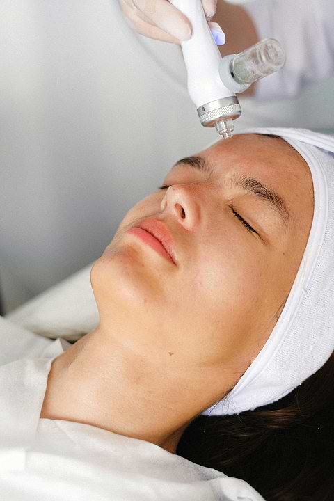 Hydrafacial et rosacée.