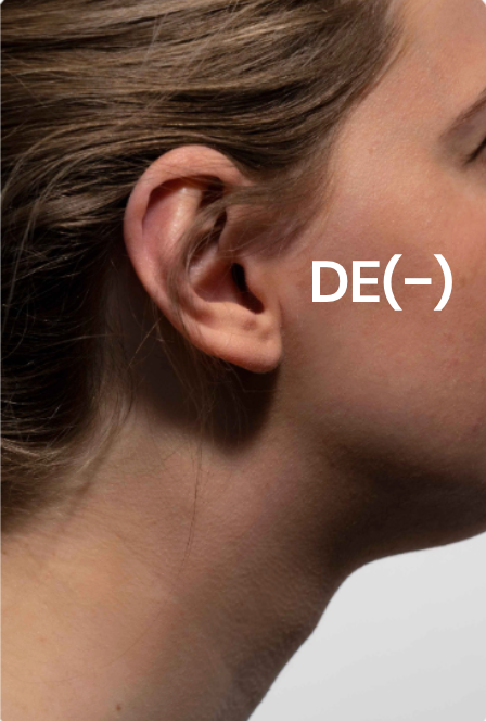 Typologie de peau DE(-).
