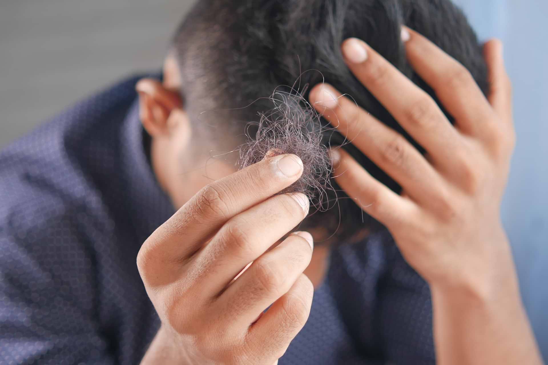 Ortie et repousse des cheveux