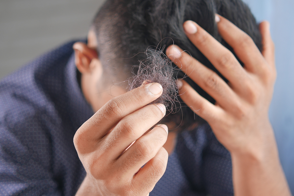 Comment savoir si notre perte de cheveux est normale ?