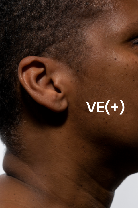 Typologie de peau VE(+).