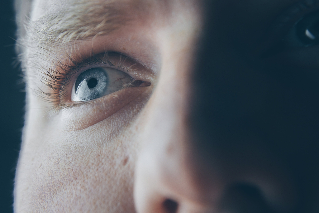 Informations rhinophyrma
