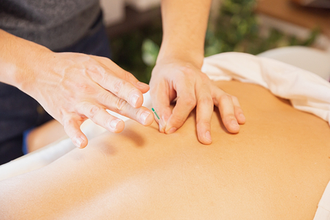 Efficacité acupuncture psoriasis.