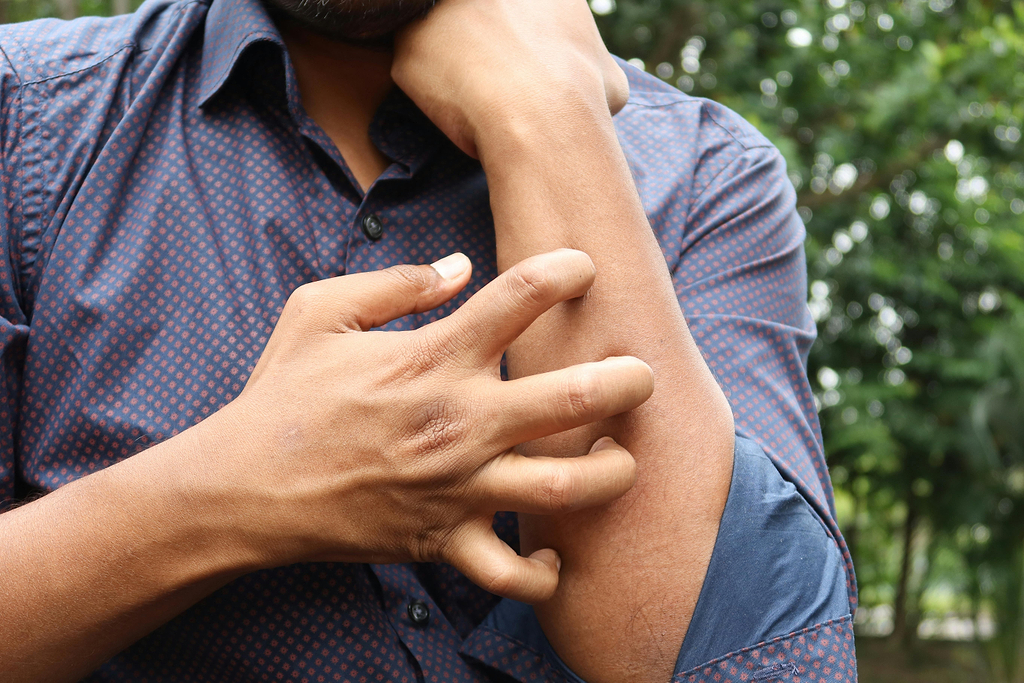 Symptômes allergie cutanée
