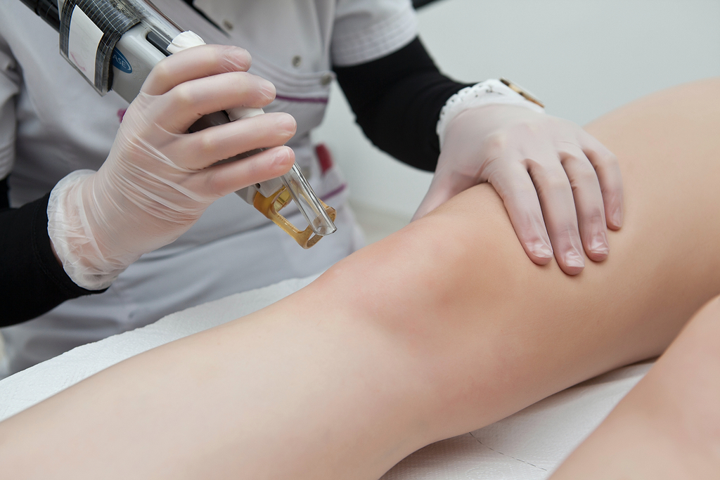 Idées reçues sur l'épilation définitive au laser.