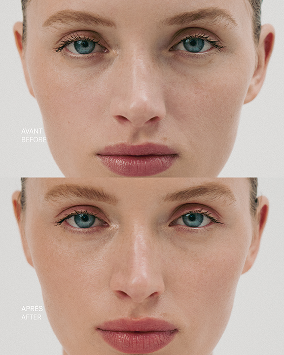 Roseglow Drops T35 — Typology