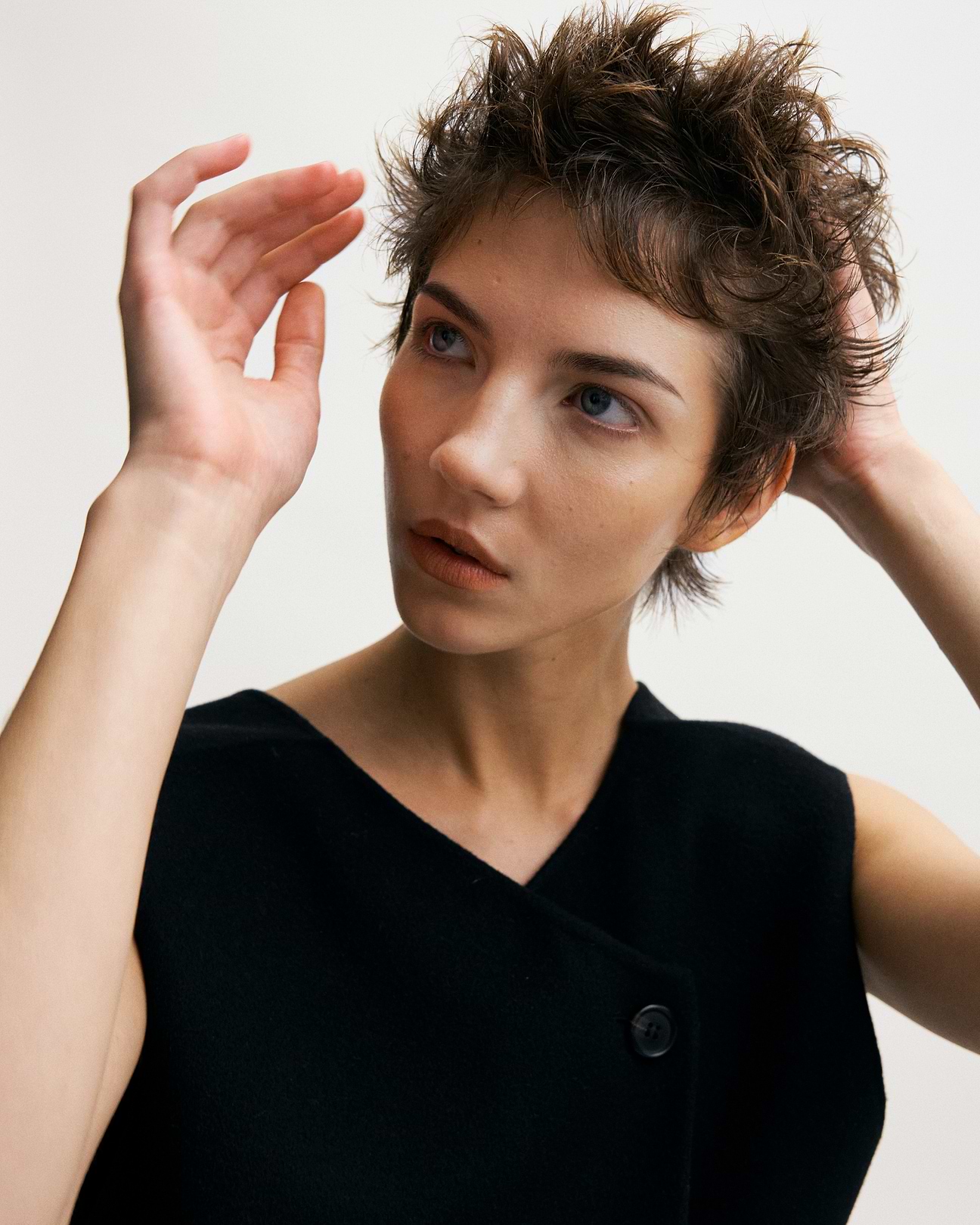 Causes perte de cheveux lupus.