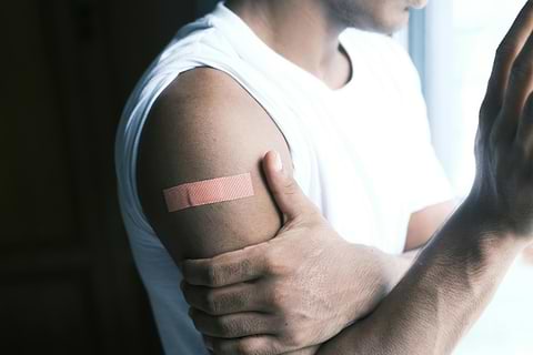 Patch en nanofibres et psoriasis