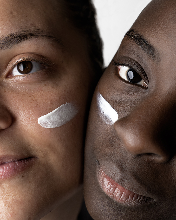 Psoriasis du visage : quelle crème choisir ?