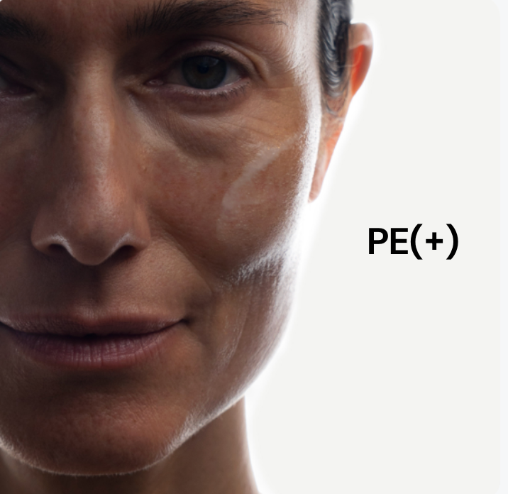 Typologie de peau PE(+).