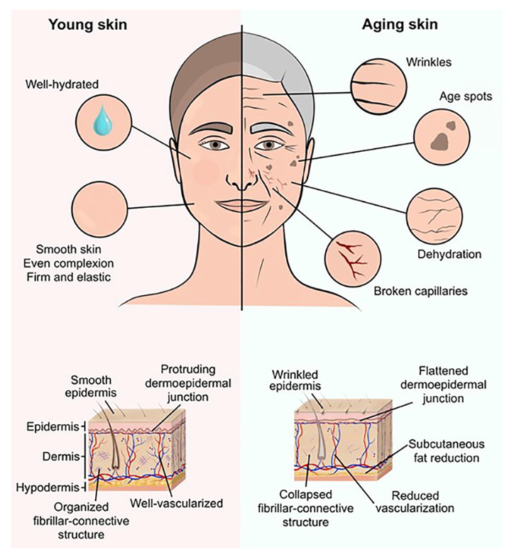 Comparaison illustrative entre la peau jeune et vieillissante.