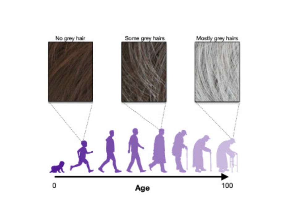 Le processus d'apparition des cheveux blancs.