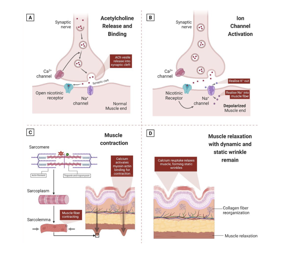 Activation neuromusculaire et rôle dans le développement des rides. La libération de l’acétylcholine déclenche une contraction musculaire (A) ; la contraction musculaire médiée par le calcium entraîne une déformation de la peau (B) ; des contractions musculaires persistantes (C) ; et la formation de rides statiques lorsque les muscles se détendent et que le calcium est réabsorbé dans le réticulum sarcoplasmique (D).