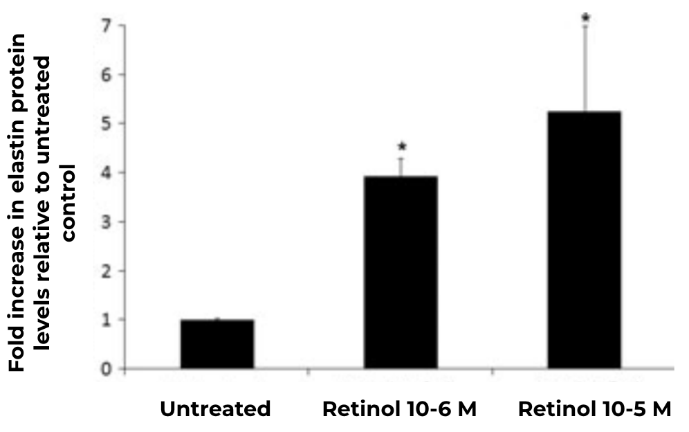 Effets du rétinol sur la synthèse d'élastine dans des explants de peau humaine.