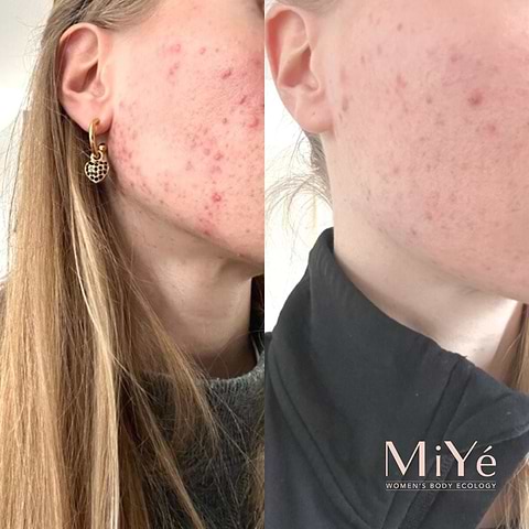 MY Detox Elixir Heldere Huid