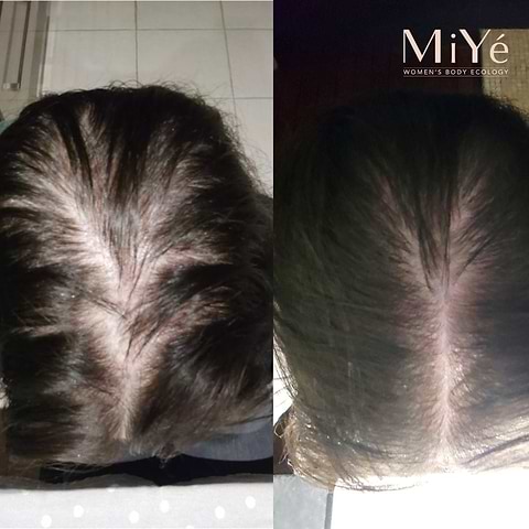 MY Densifying Anti-Hair Loss Hair Serum