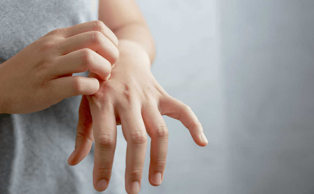 Trucs et astuces pour faire fuir les moustiques !