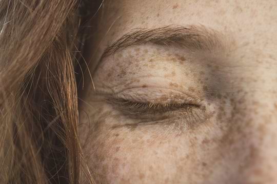 Eczéma : les bons réflexes alimentaires 