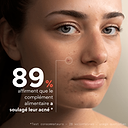 Pimple-Stop Supplement 2