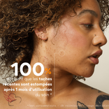 Anti-Dark Spot Skin Care 3
