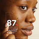 Acne Pimple Patches 3