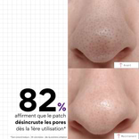 Patchs Nez Purifiants Pores 1