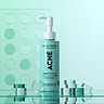 ACNE Reinigingsschuim Sebum Controle 2