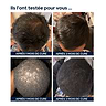 Hair Loss Cure for Men 1 Month 2