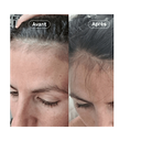 Voedingssupplement Haargroei 1