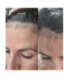 Hair Growth Supplement 1