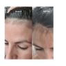 Voedingssupplement Haargroei 1