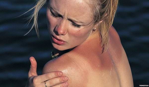 Soins réparateurs coups de soleil