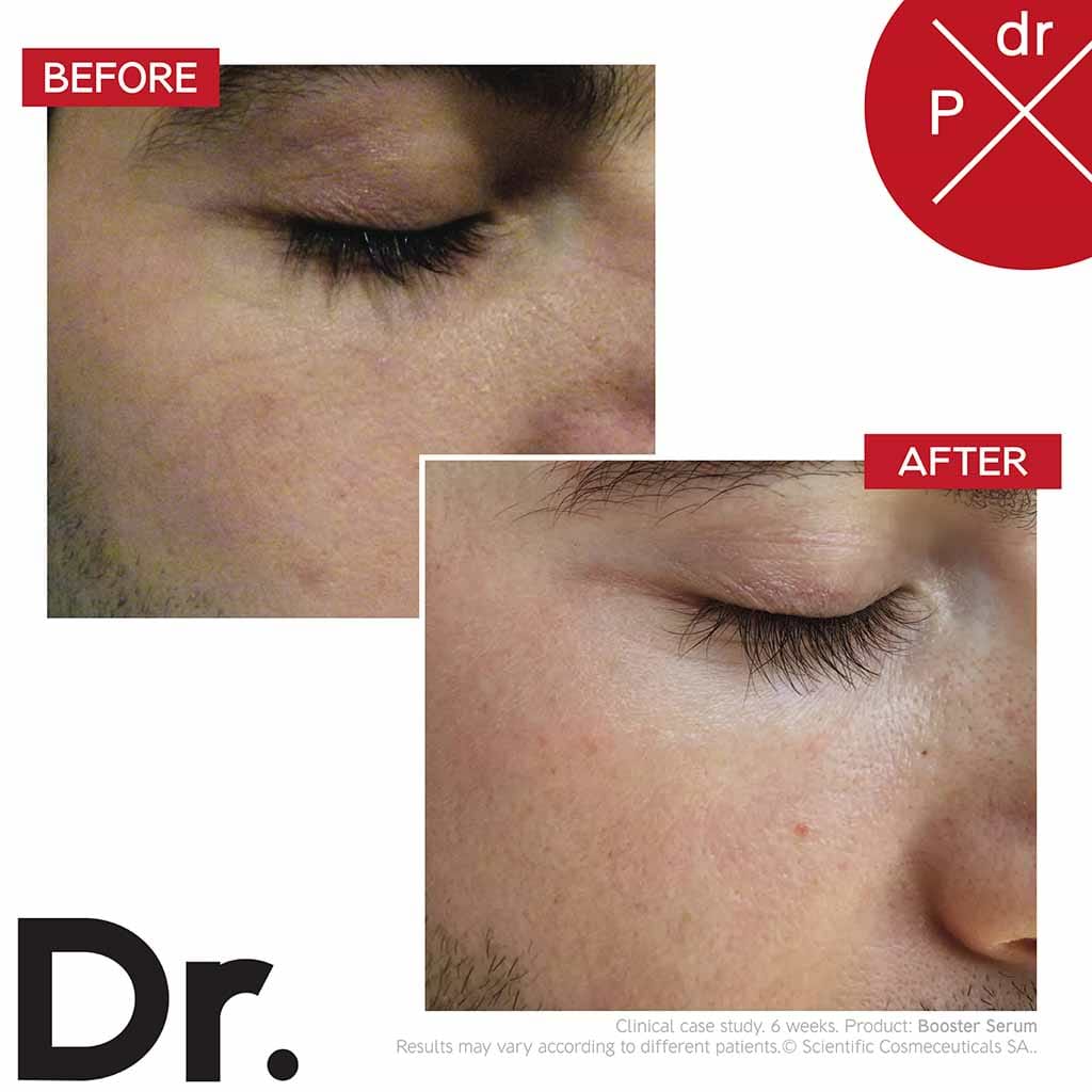 Dr.Levy Booster Face Serum 30ml - DR. LEVY - Duty Free